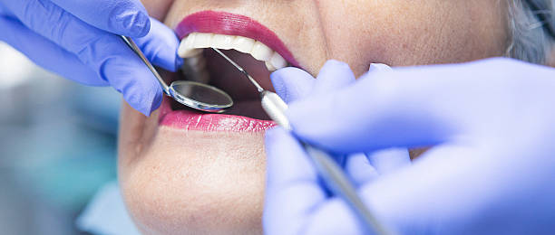 Best Knocked-Out Tooth Emergency  in Brigantine, NJ